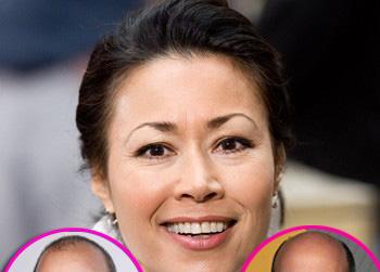 //anne cury zucker wenn_