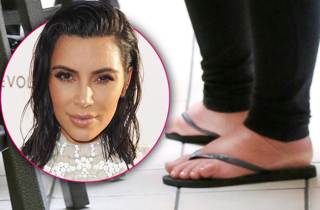 kim kardashian swollen feet cankles hammer toe surgery