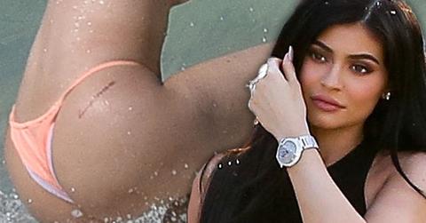 Kylie Jenner Butt Red Scar Plastic Surgery Rumors