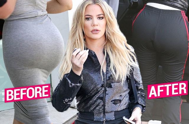 Khloe Kardashian Butt Implant Rumors -- KUWTK Star Booty Is Deflating, Say  Top Plastic Surgeons