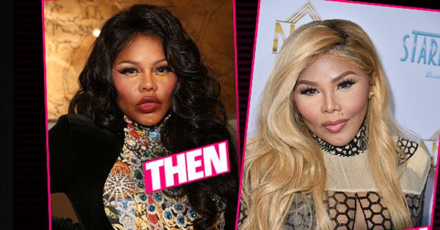 //lil kim plastic surgery transformation unrecognizable pp