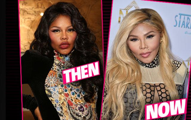 Lil Kims Drastic Plastic Surgery Transformation Exposed 