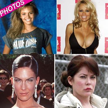 From The Tube To The Plastic Surgeon's Office! TV Stars Who've Gone Under  The Knife