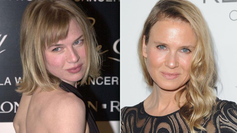 It S Not The Knife It S My Happy New Life Renee Zellweger Sidesteps Plastic Surgery Questions Says Drastic Change In Look Is Result Of Different Lifestyle