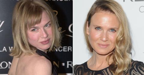 //renee zellweger then and now