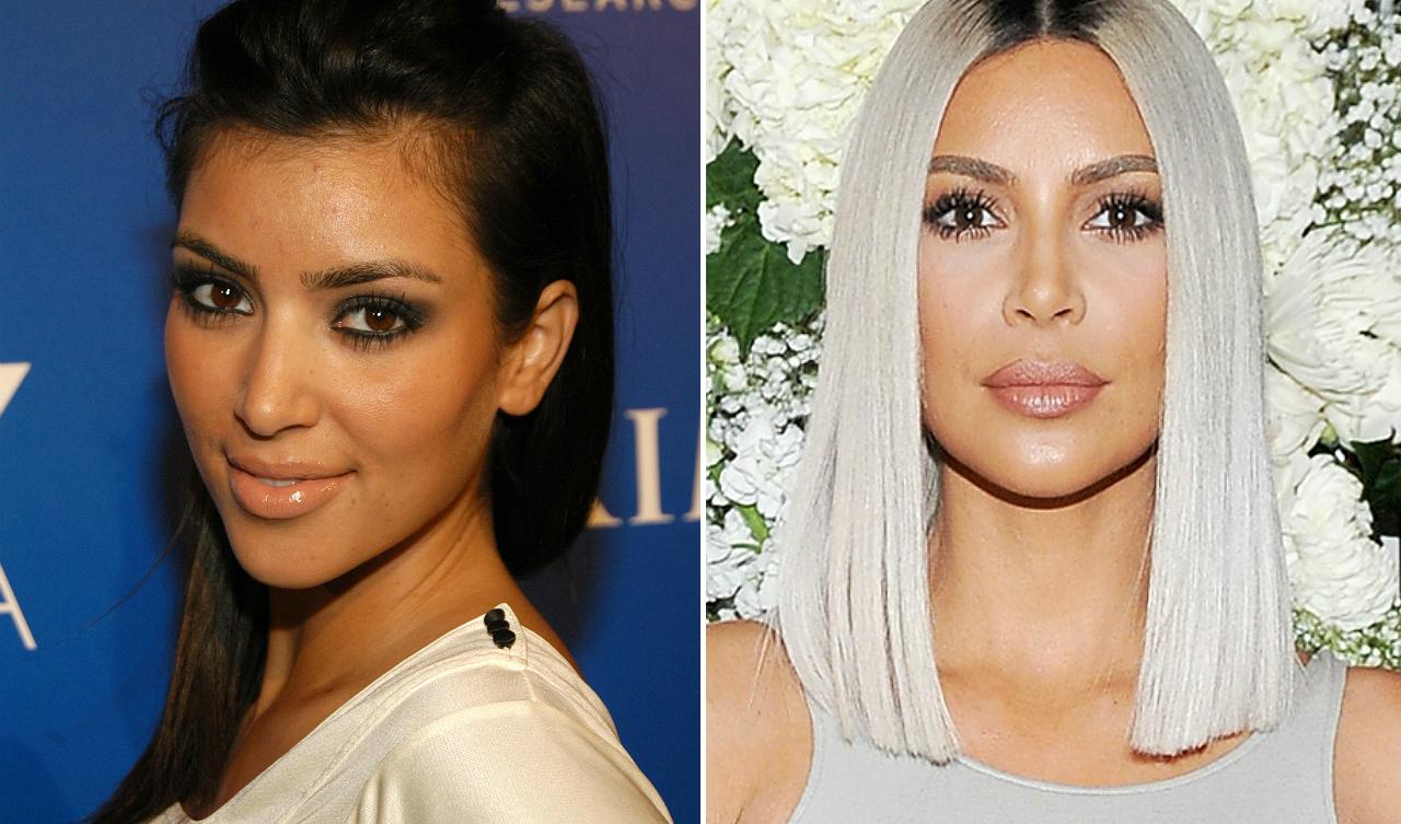 Kim Kardashian Nose Plastic Surgery 