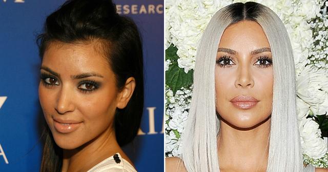 Kim-Kardashian-Nose-Plastic-Surgery
