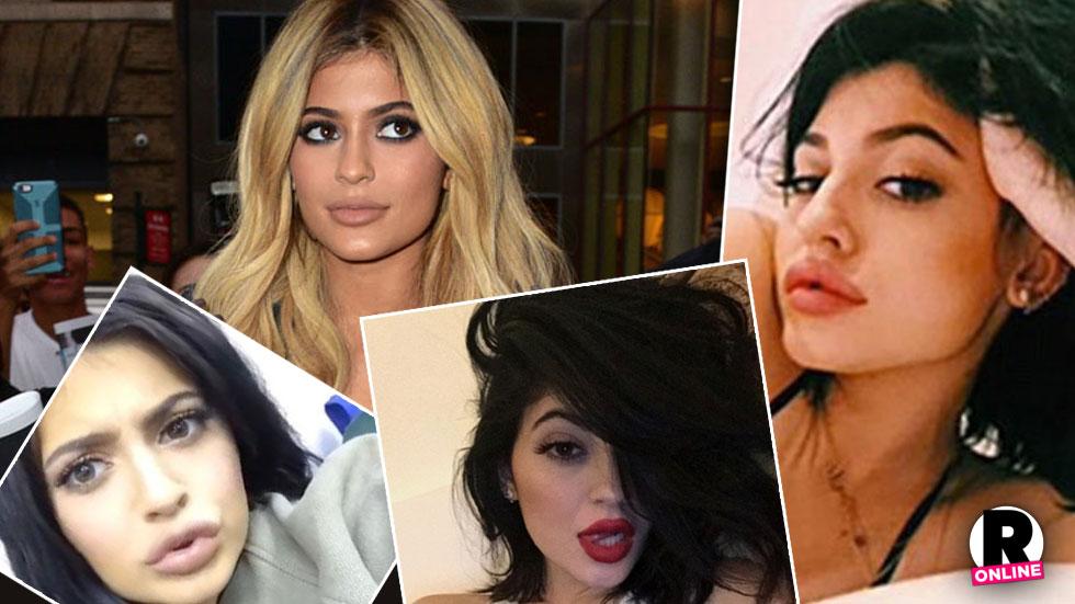 Kylie Jenner's doctor discusses her changing face