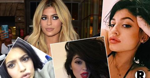 Kylie-Jenner-Plastic-Surgery-Stop-Now