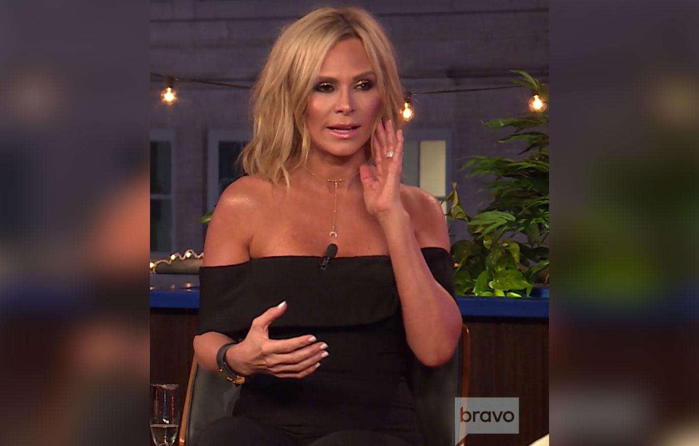 tamra judge plastic surgery face lift rhoc wwhl pics