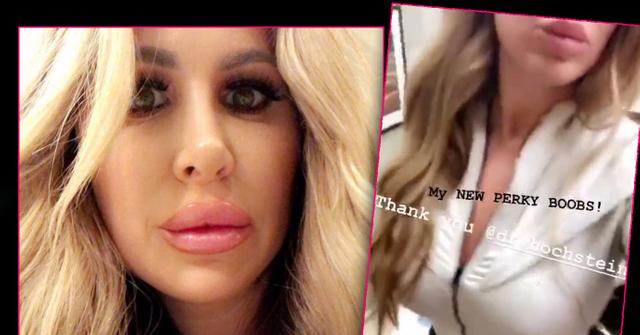 Kim Zolciak Objects To Lip Filler Haters Shows Off Perky New Boobs 