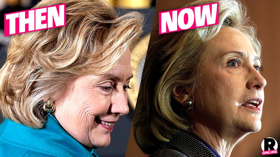 Hillary Clinton Plastic Surgery