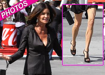 //janice dickinson legs wrinkly pcn