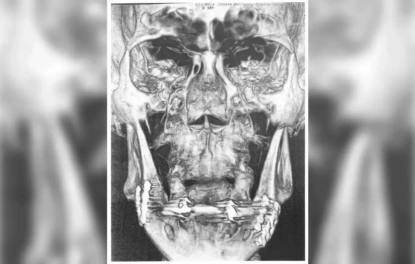 Security Guard Suing Nicki Minaj Over Husband Petty's Alleged