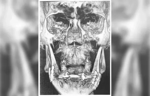 nicki minaj husband kenneth petty sued germany security guard assault court default judgment suffers small setback megan thee stallion