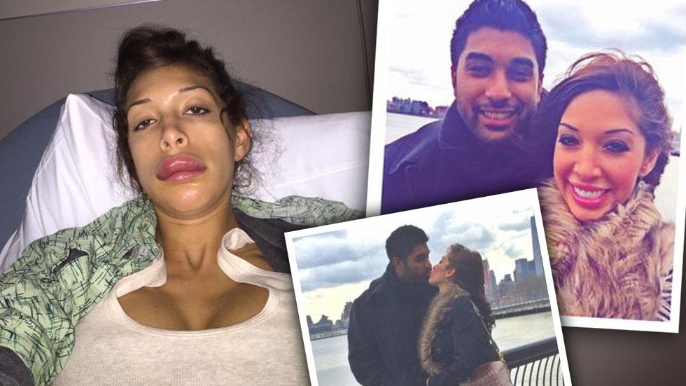 Farrah Abraham Botched Lip Injections Fixed