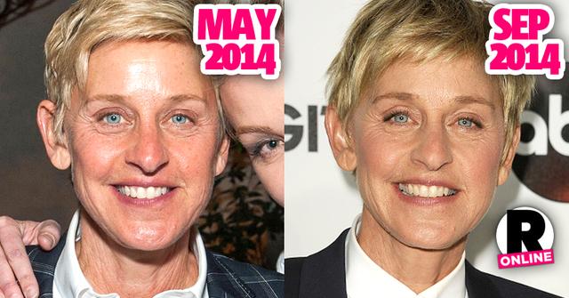 //ellen degeneres portia de rossi plastic surgery pp