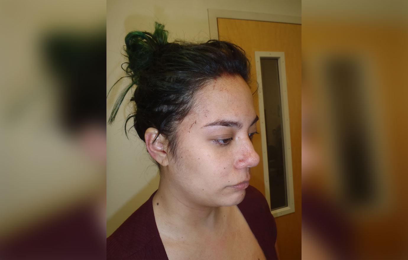 Woman Who Stabbed Her Boyfriend With A Samurai Sword Bloody Photos