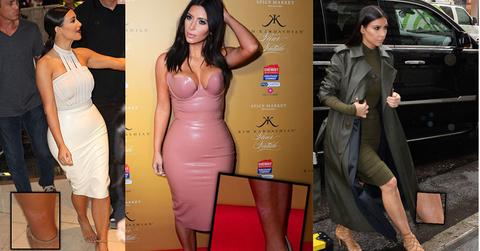 //Kim kardashian psoriasis