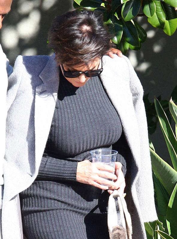 Kris Jenner Bald Spot