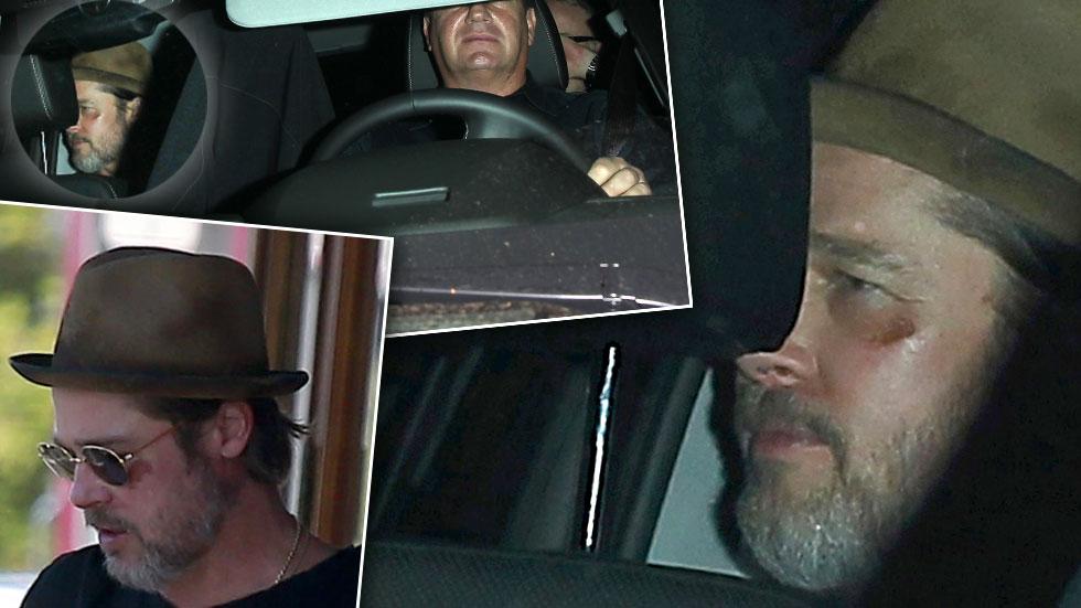 Brad Pitt Bruised Face