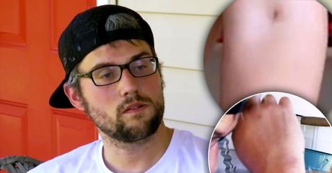 ryan edwards track mark photos drug use teen mom