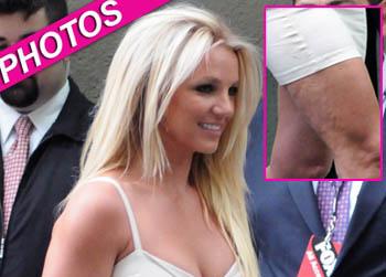 //britney spears dress cellulite inf