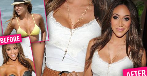 Melissa Gorga Implants Photos