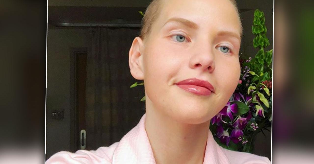 Elly Mayday, A Model & Activist Dies After Ovarian Cancer Battle