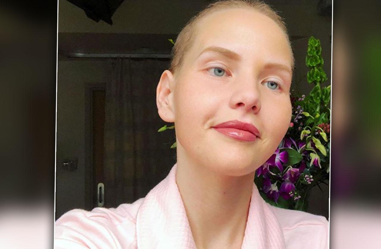 Elly Mayday, A Model & Activist Dies After Ovarian Cancer Battle