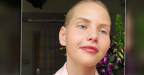 Elly Mayday Model Activist Dies Ovarian Cancer Battle