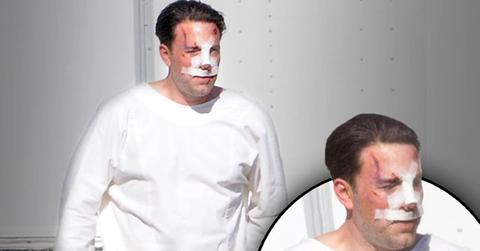//ben affleck plastic surgery rumors bloody on set pp