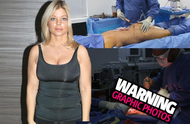 VIDEO] Donna Derrico Baywatch Plastic Surgery Before Photos