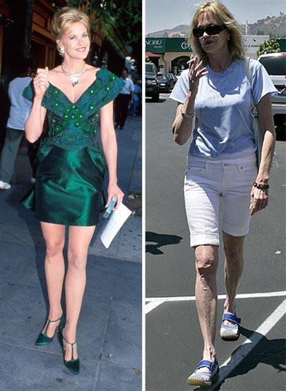 //melanie griffith shocking transformation