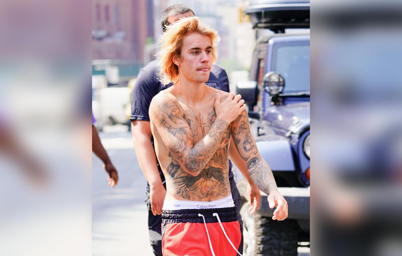 Justin Bieber Pimple Breakouts Hailey Baldwin Engagement