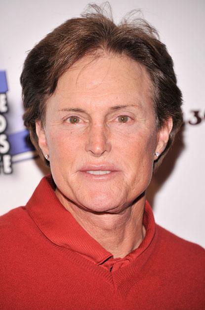 //bruce jenner reality star plastic surgery