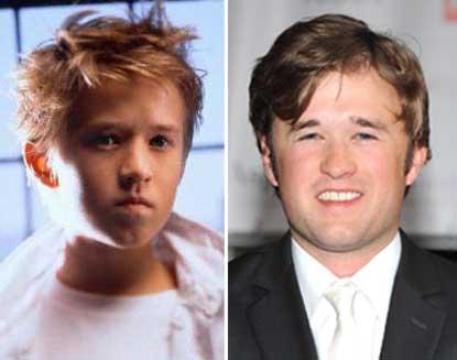 //haley joel osment child star plastic surgery