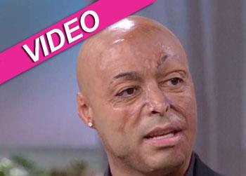 //j r martinez video dr drew life changers