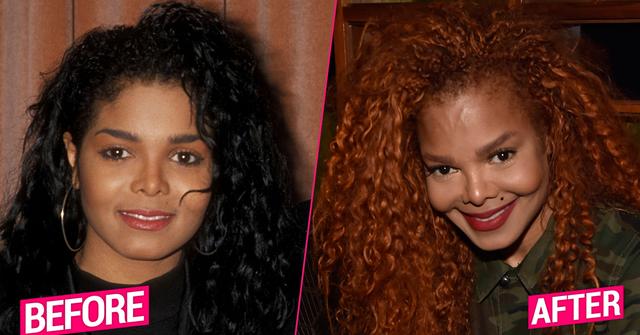Janet Jackson before and after plastic surgery photos