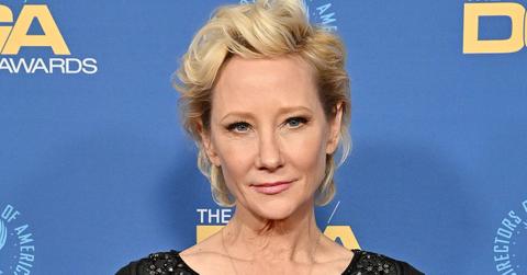 anne heche hospitalized burned fire car crash