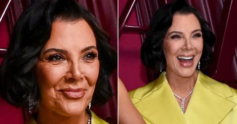 Fans feared Kris Jenner’s facelift was failing after spotting signs of drooping and tightness.