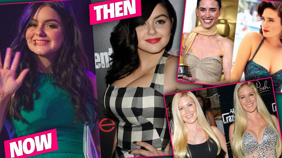 Celebrities who have had breast reductions