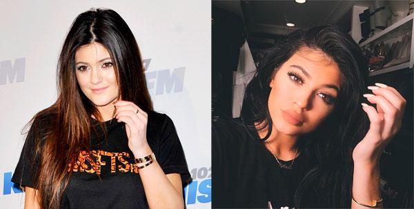 //kylie jenner plastic surgery top doctor estimates boob job face work extensions