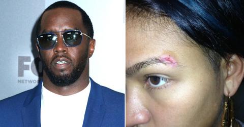 Split photo of Sean Combs and Cassie Ventura injuries
