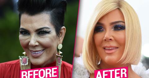Kris Jenner's Plastic Surgery Makeover Exposed By Top Docs