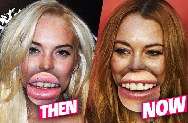 //lindsay lohan teeth rotted bad pp