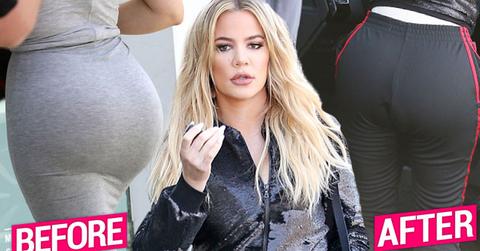 Khloe Kardashian Plastic Surgery Butt Implants Deflating