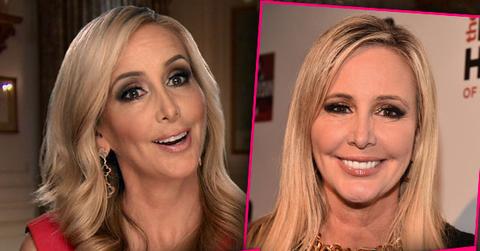 //Shannon Beador Plastic Surgery Fillers Botox Nose Job pp