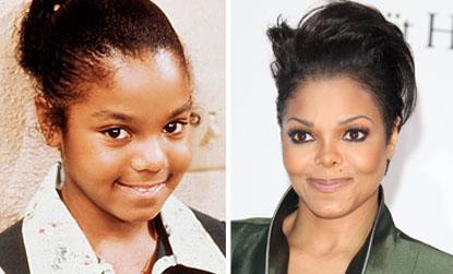 //janet jackson child star plastic surgery
