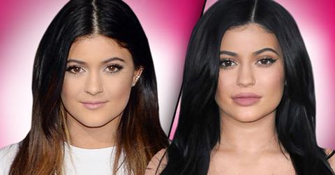 //Kylie Jenner Plastic Surgery Makeover pp